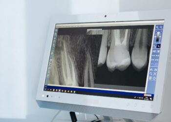 tomografia komputerowa szczeki